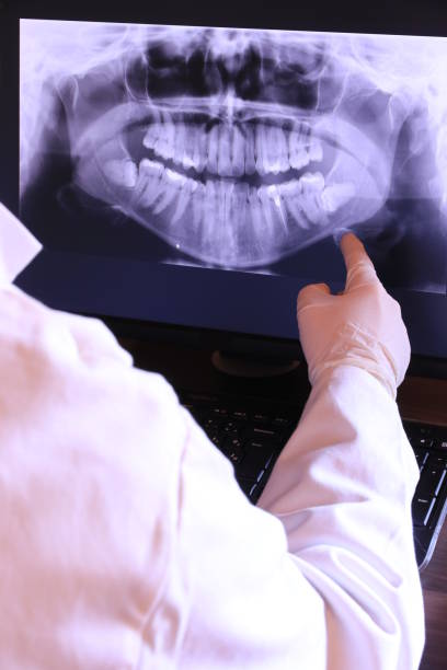 Best Emergency Dental Care for Broken or Chipped Teeth in Fontana, CA