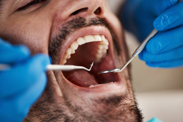 Best Urgent Care for Lost Fillings or Crowns in Fontana, CA